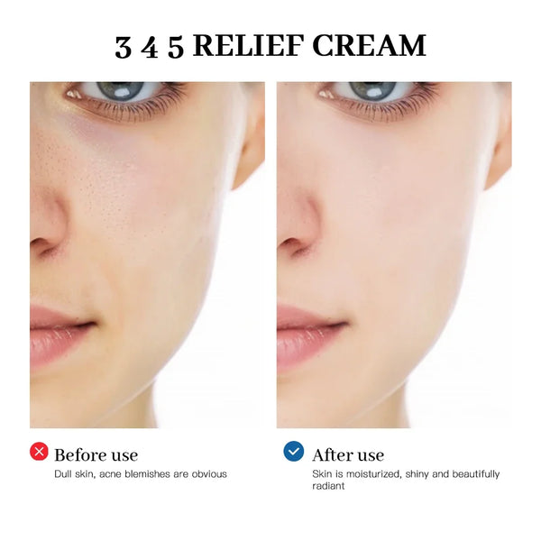 Relief Renew Daily Skin Cream