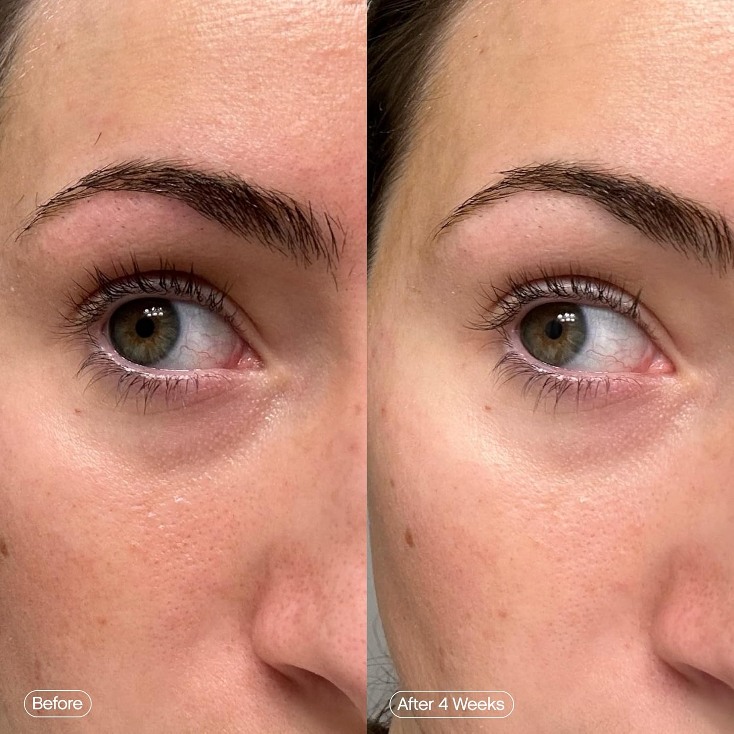 Faded Under Eye Rescue