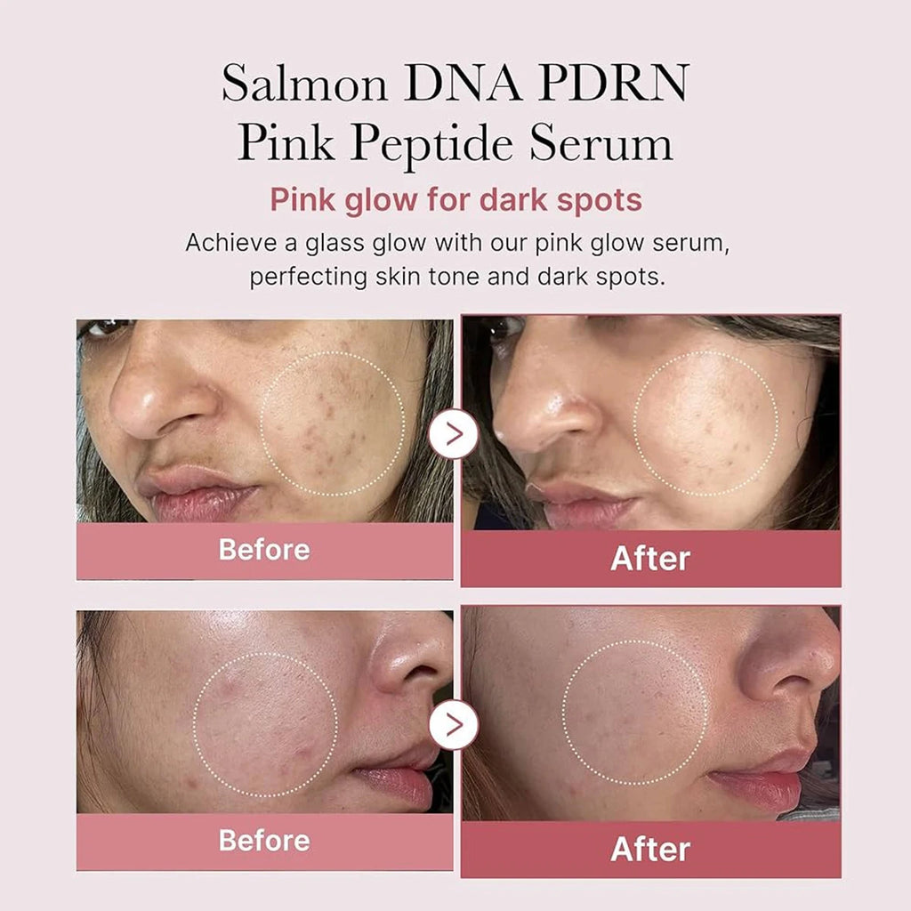 Salmon DNA PDRN Repair Serum